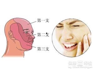 白瓜吃的上颚痛,白瓜食用引发上颚疼痛之谜探究